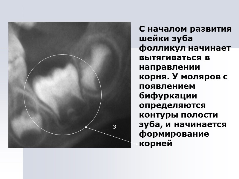 С началом развития шейки зуба фолликул начинает вытягиваться в направлении корня. У моляров с